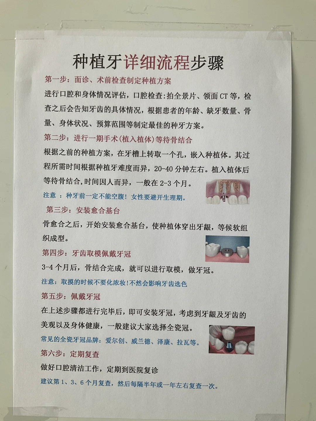 还没种牙的收藏→种植牙详细流程步骤,AA69代孕成功案例-孕宝代孕网